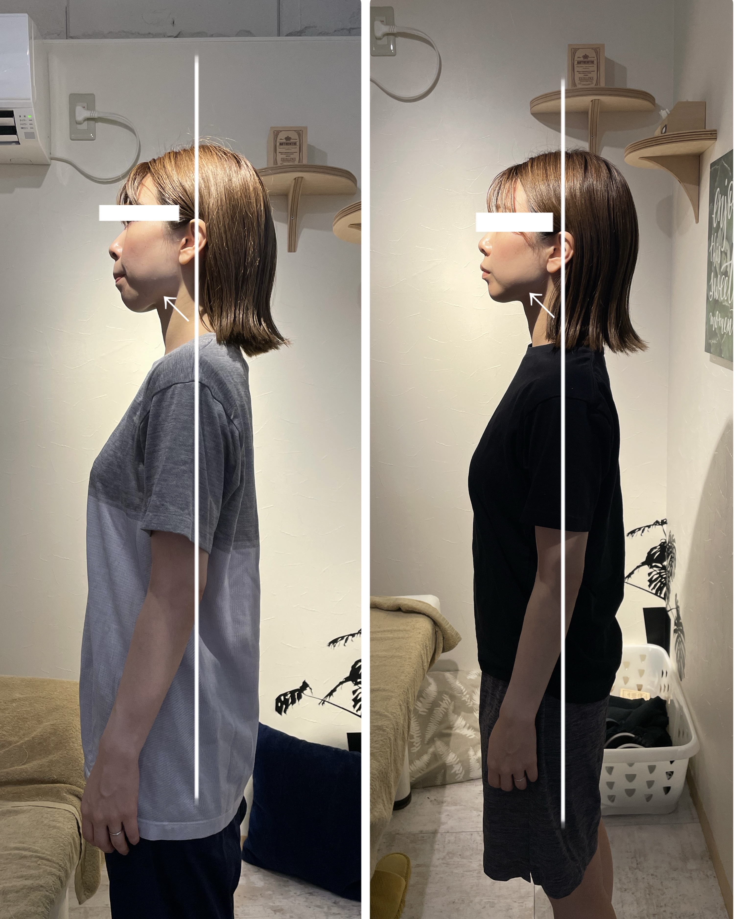 鍼灸整骨院Refine 美容整体　初回体験￥12000→￥4980のメニュー画像