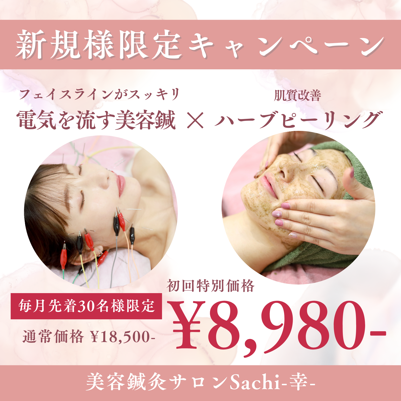 美容鍼灸サロン　Sachi-幸- 【新規様限定】肌質改善コースのメニュー画像