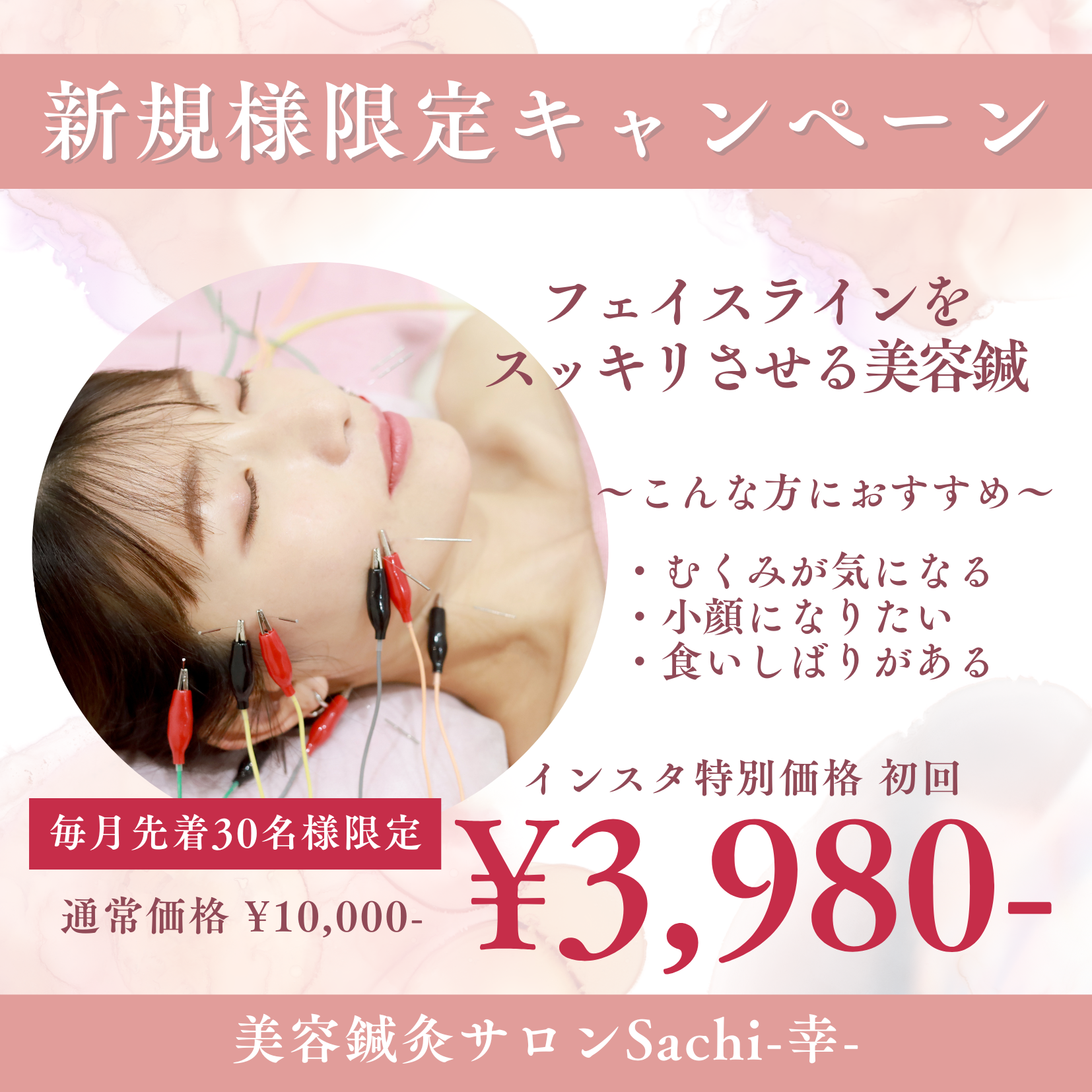 美容鍼灸サロン　Sachi-幸- 【新規様限定】電気を流す美容鍼のメニュー画像