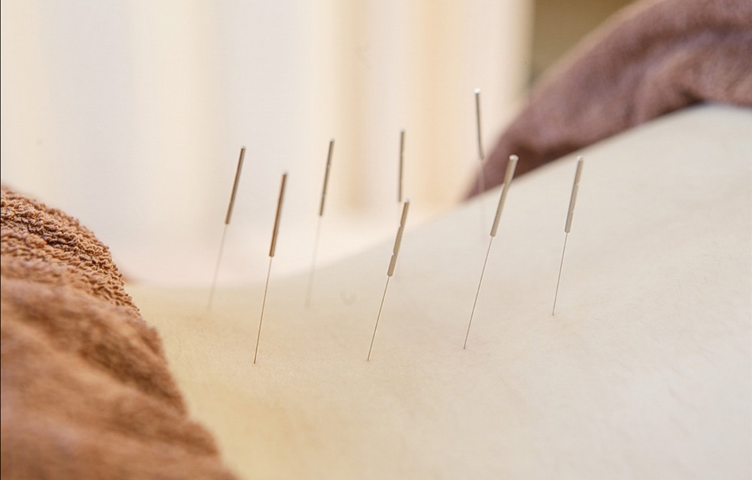 あんしんはり灸堂 【初回カウンセリング0円＋施術料半額！】痛み改善！はり灸整体60分のメニュー画像