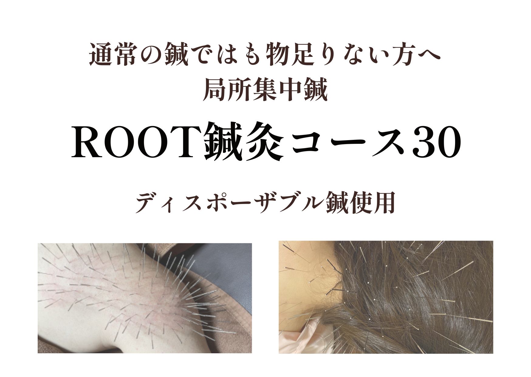 ゆり鍼灸院 ROOT鍼灸・BODY（30min）のメニュー画像