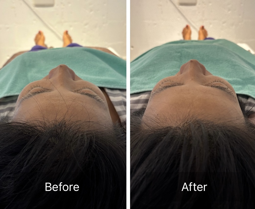 はり・きゅう・あんまマッサージ指圧治療院 癒鎮 【骨格からしっかり整える】健美コース　初めての方のメニュー画像