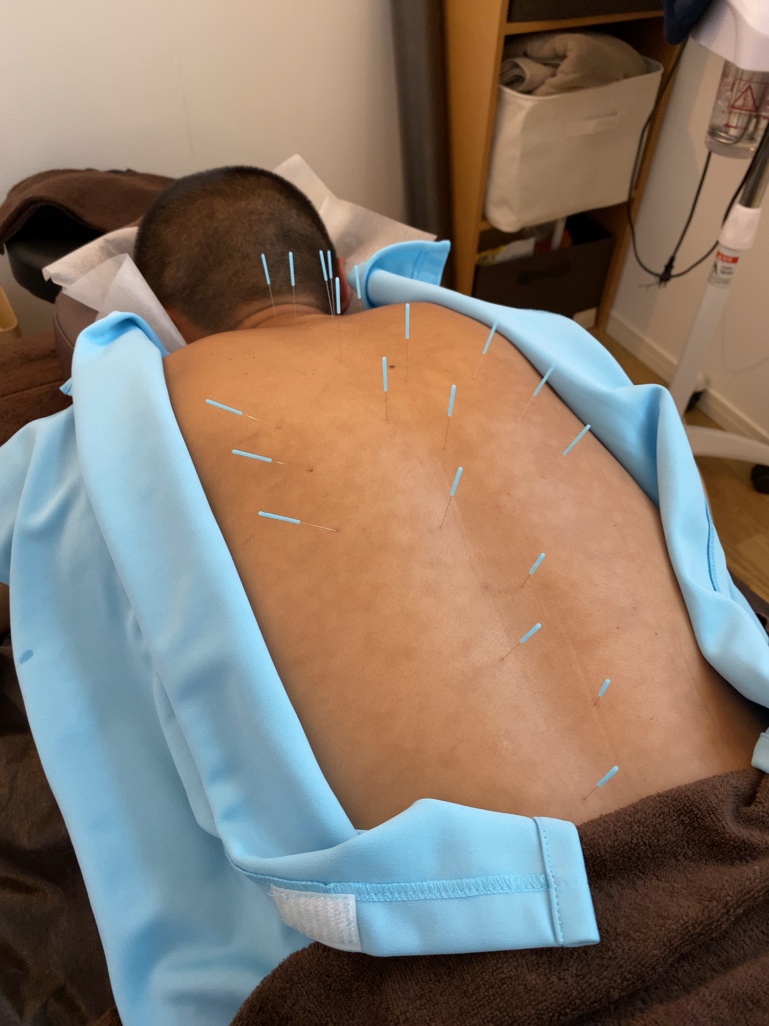 はり・きゅう・あんまマッサージ指圧治療院 癒鎮 【ベーシック治療ならこちら】総合鍼灸マッサージ　2回目以降のメニュー画像