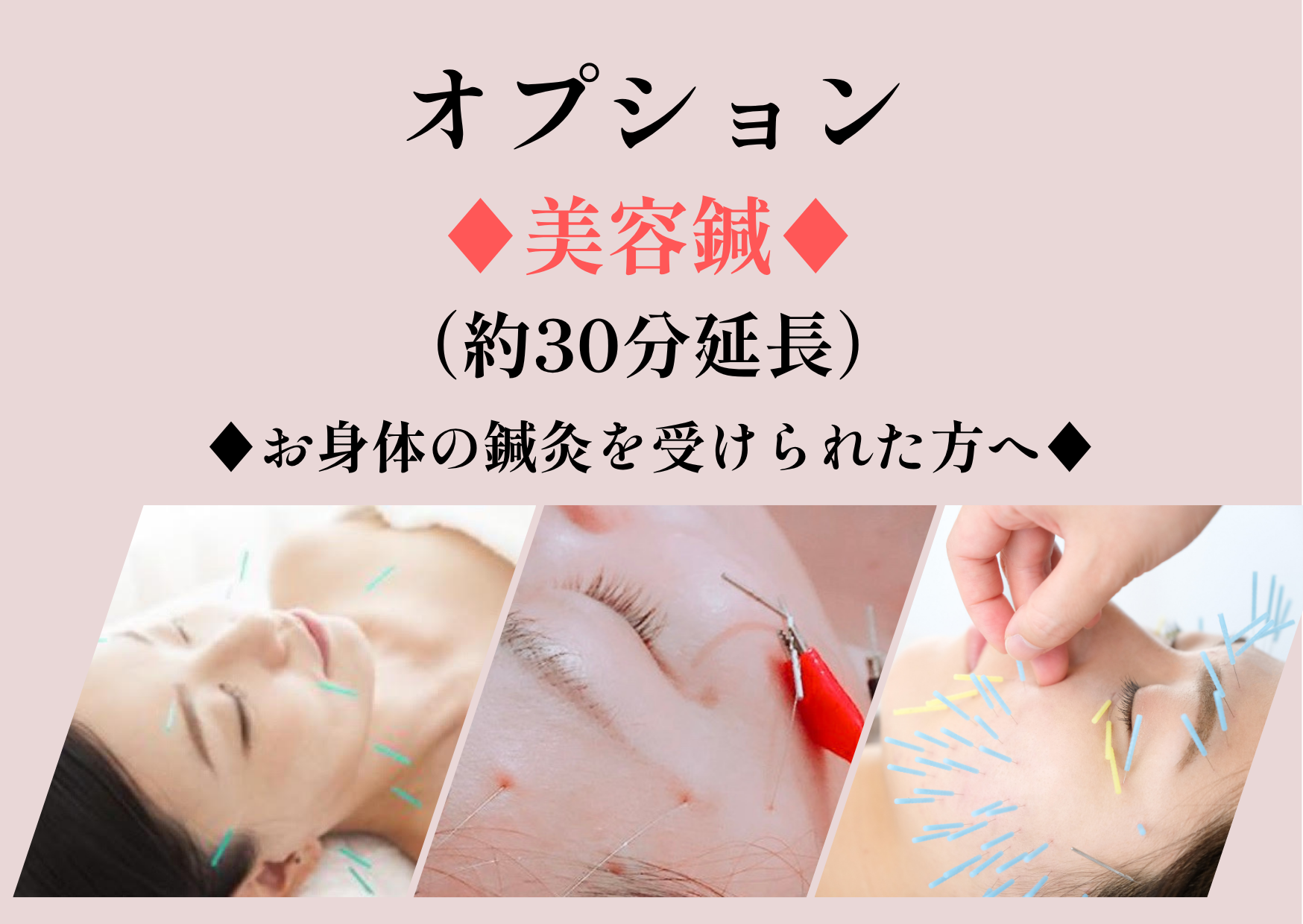 ゆり鍼灸院 ★美容鍼プラス★【オプションメニュー】のメニュー画像