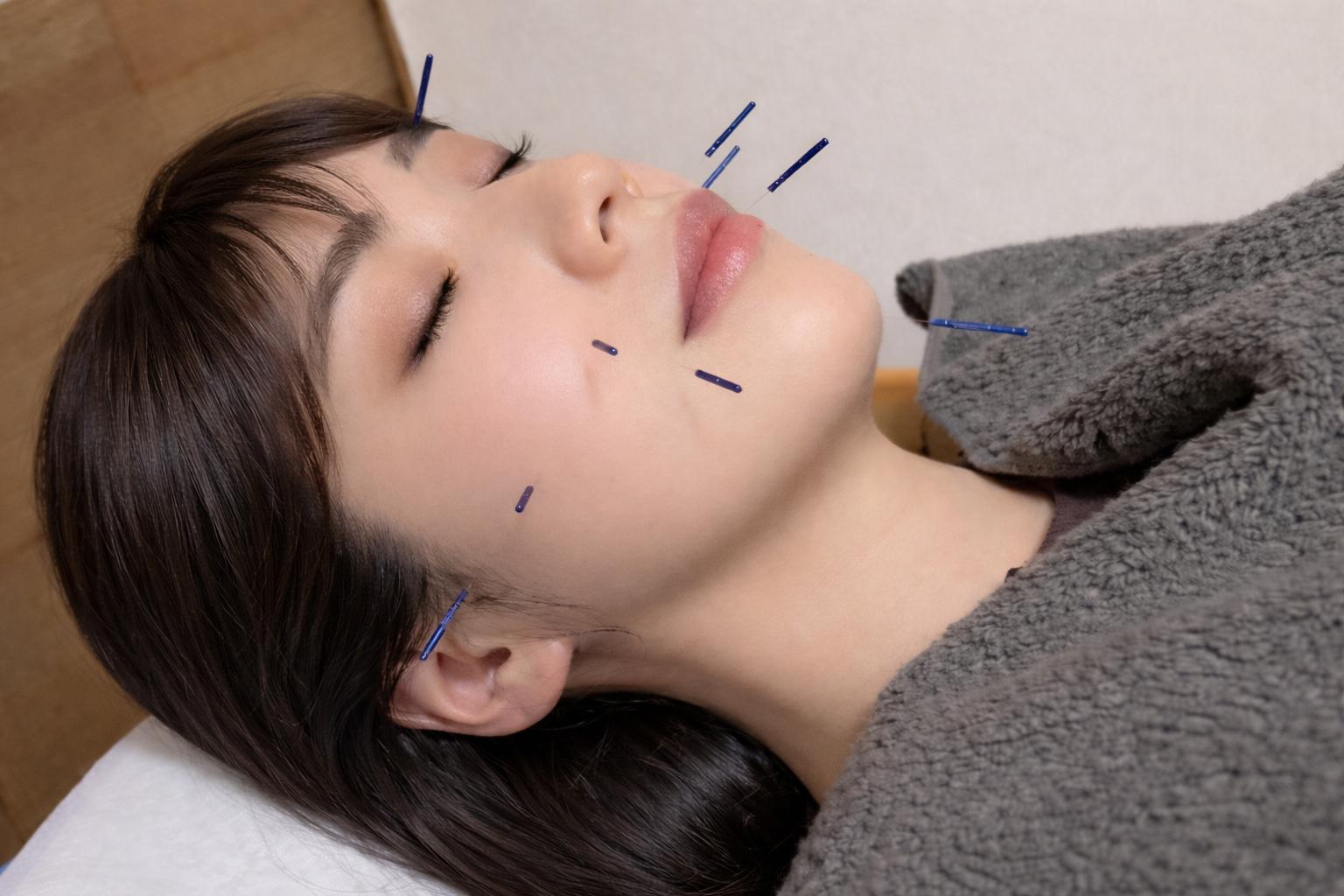 東垣鍼院 【初回特別コース】美容はり施術のメニュー画像