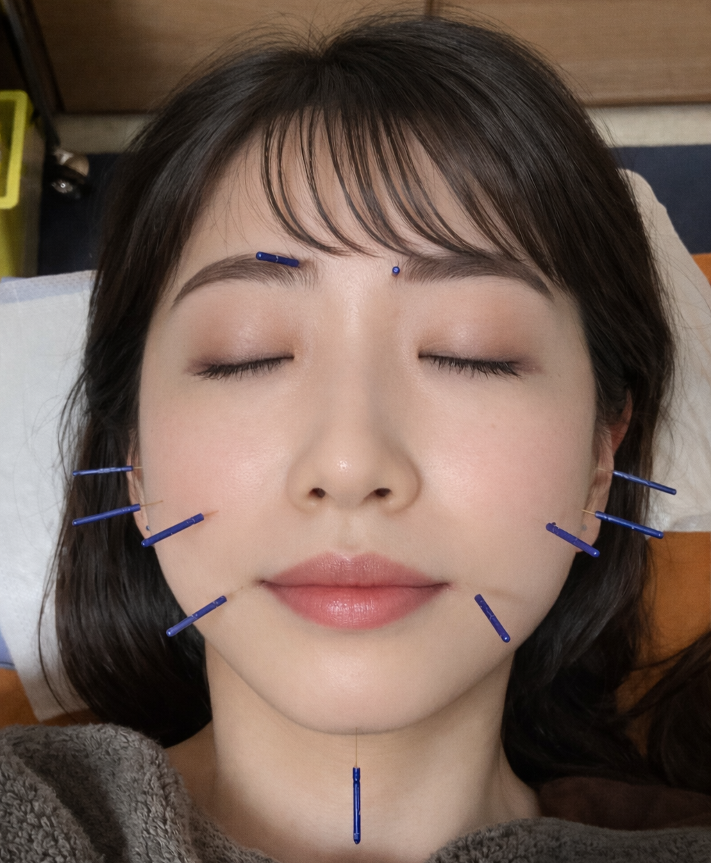 東垣鍼院 美容はり施術のメニュー画像