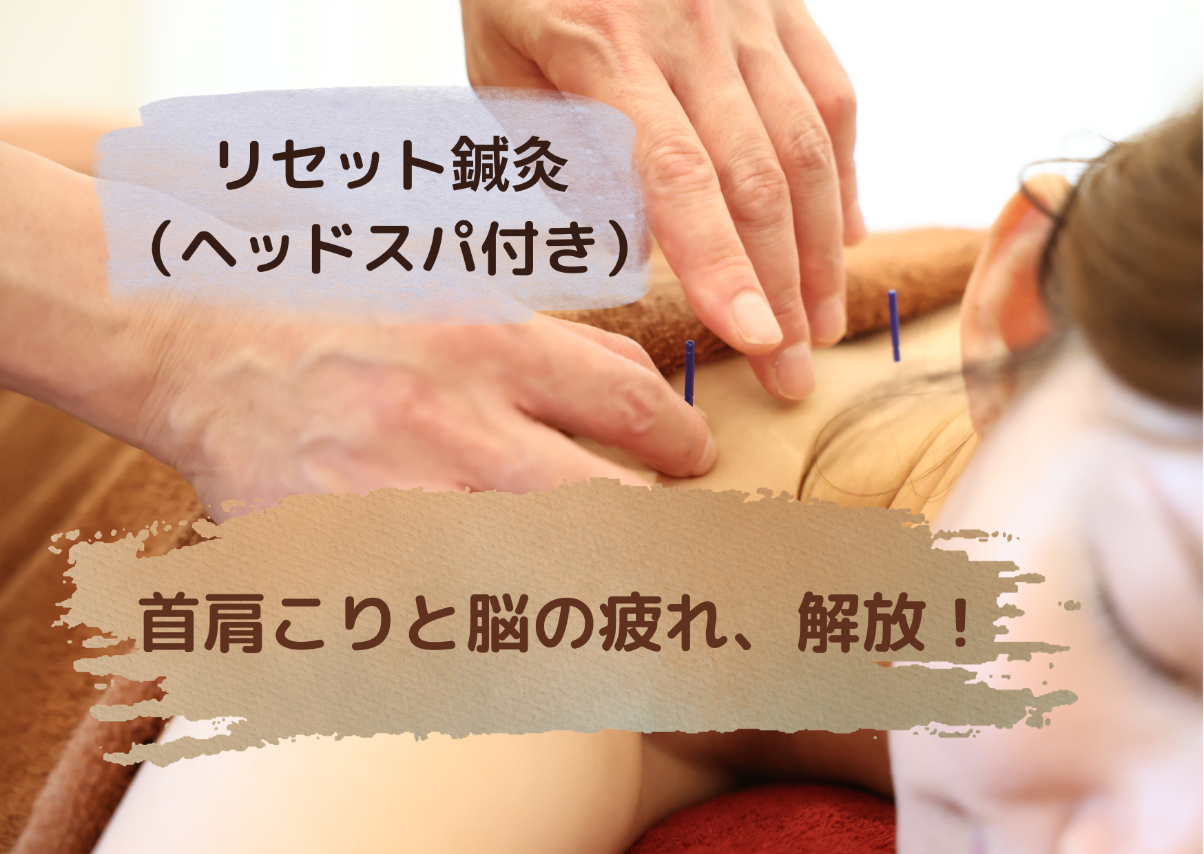 ヘッド&鍼灸治療院 Noel ASHIYA 【ご新規様/定番ケア】脳疲労リセット 鍼灸(ヘッドスパ付き）50分￥10000→￥6000のメニュー画像