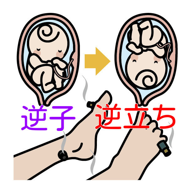 一歩堂整骨院・はり灸院・整体院 逆子(骨盤位)のメニュー画像