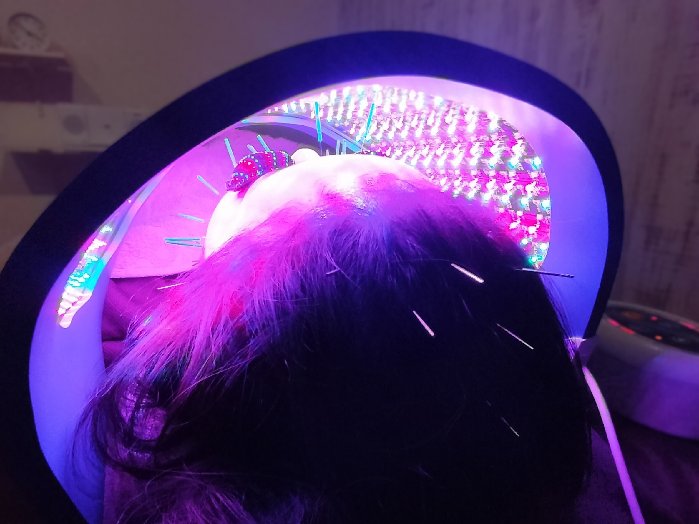 im.Hari™イムハリ全身美容鍼 Body+Beauty Facial Acupuncture 府中 掲載記念価格【ご新規の方】IM.HARI™ 美容鍼 + 全身鍼灸 + CELLUMA® iPROのメニュー画像