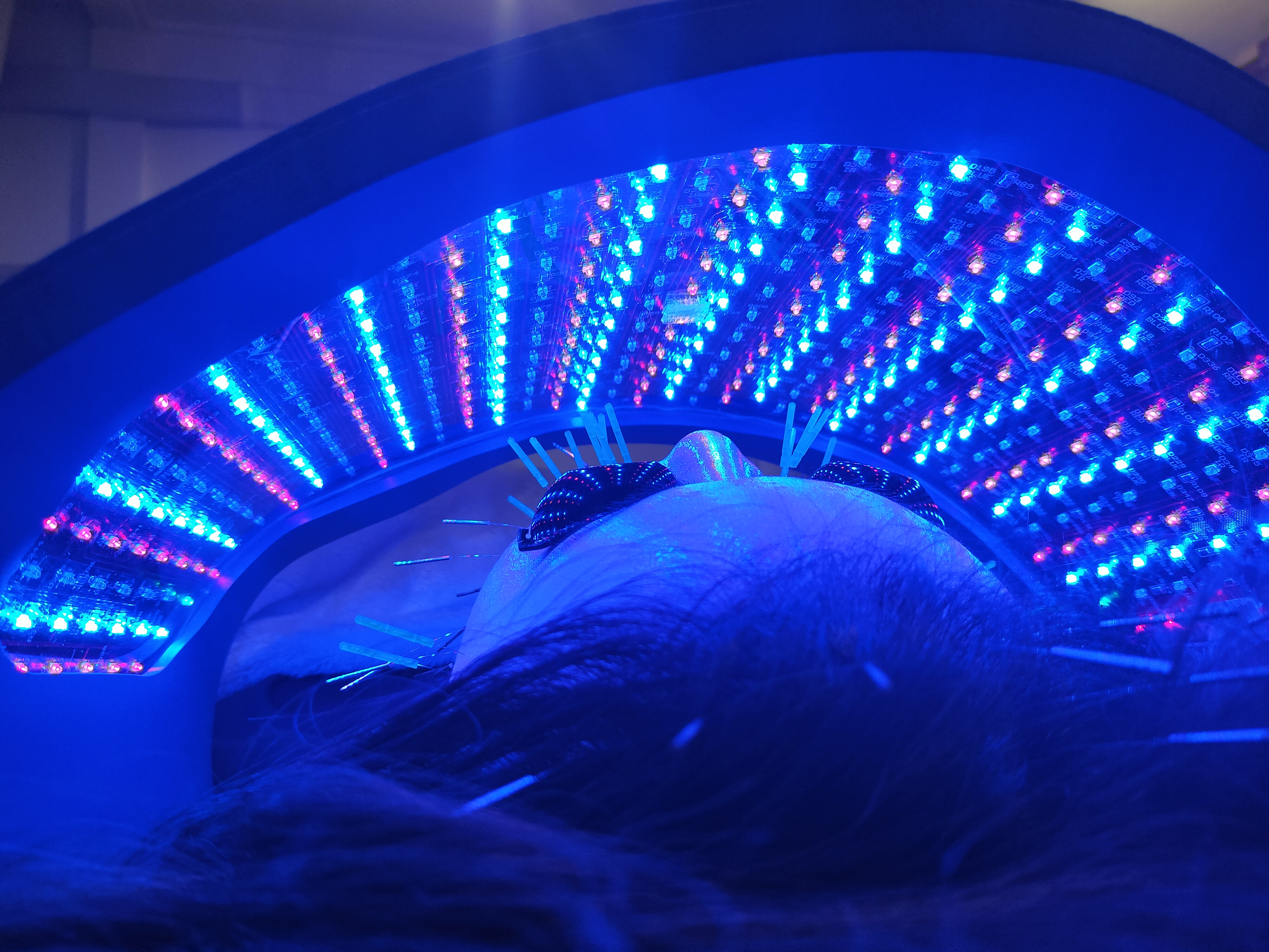 im.Hari™イムハリ全身美容鍼 Body+Beauty Facial Acupuncture 府中 掲載記念価格【4週間以内再来】IM.HARI™ 美容鍼 + 全身鍼灸 + CELLUMA® iPROのメニュー画像