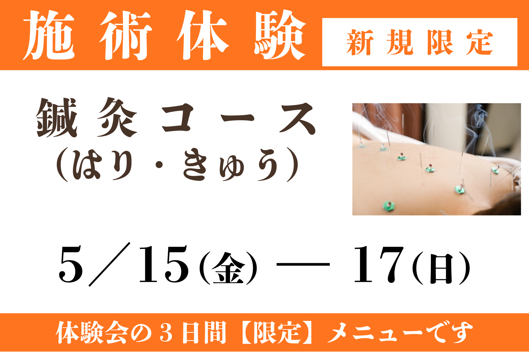 那覇市新都心スマイルなごみ鍼灸整骨院 鍼灸コース│※5/15(金)～17(日)のみ│肩こり・腰痛・頭痛などでお困りの方│ご新規様限定施術体験特別価格のメニュー画像