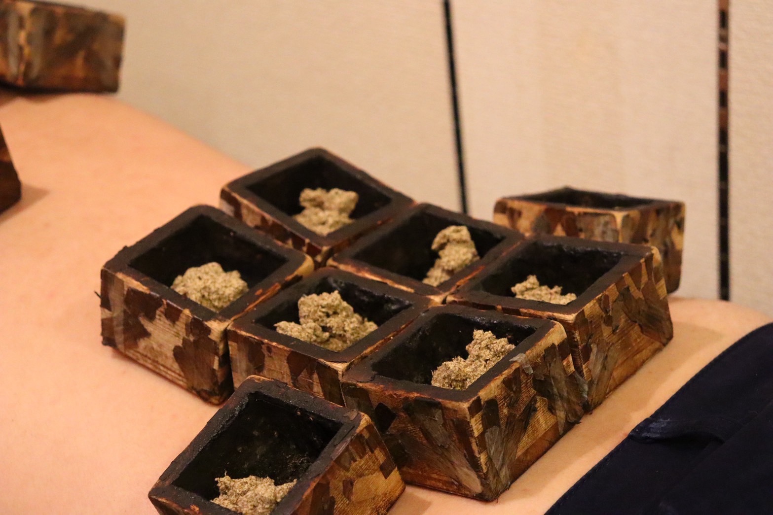 南学堂鍼灸院 升灸と鍼のメニュー画像