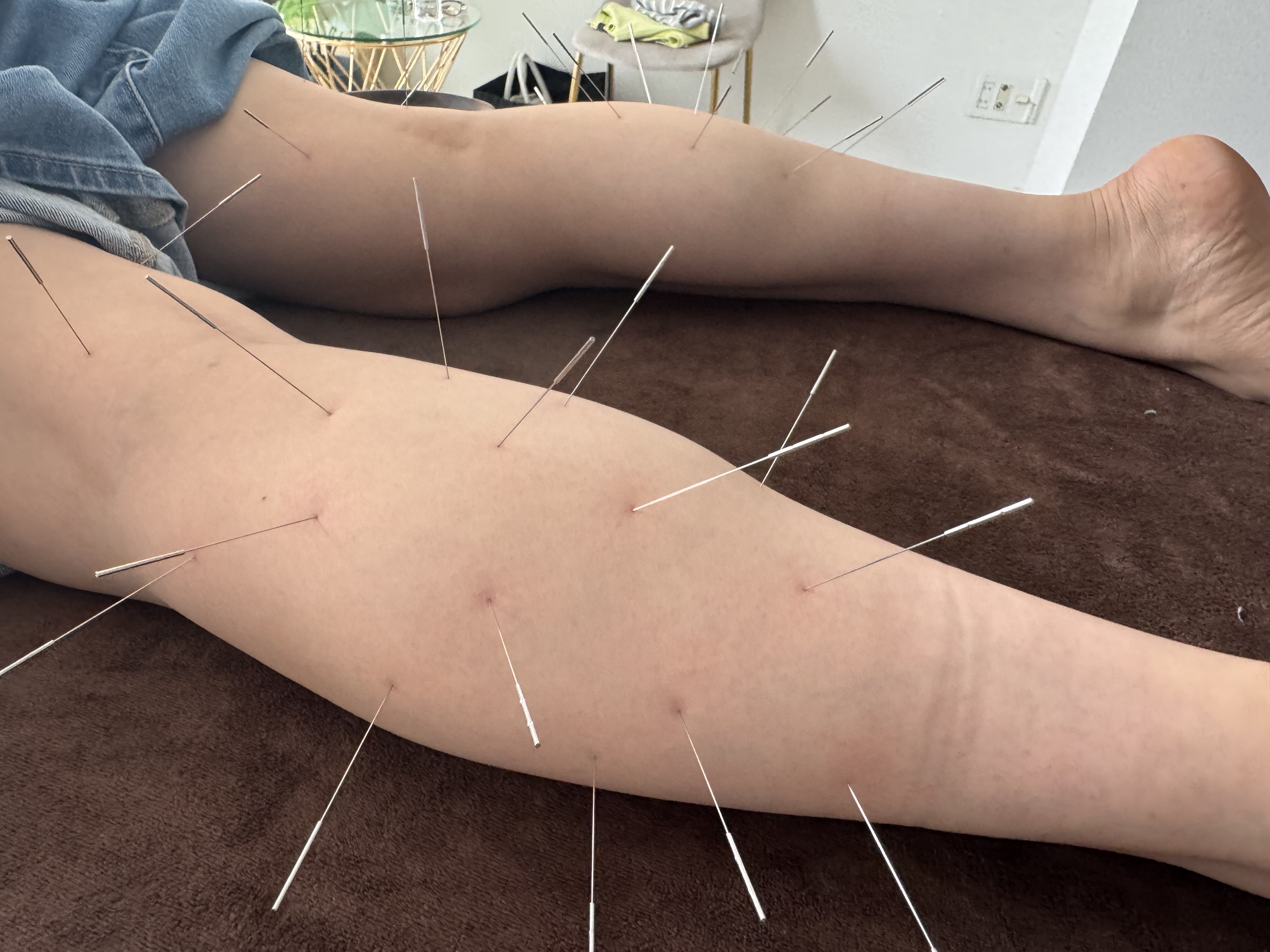 ここゆ鍼灸院-ルート治療専門院- 学生サポートルート30分｜肩こり・部活疲労・自律神経の不調にのメニュー画像