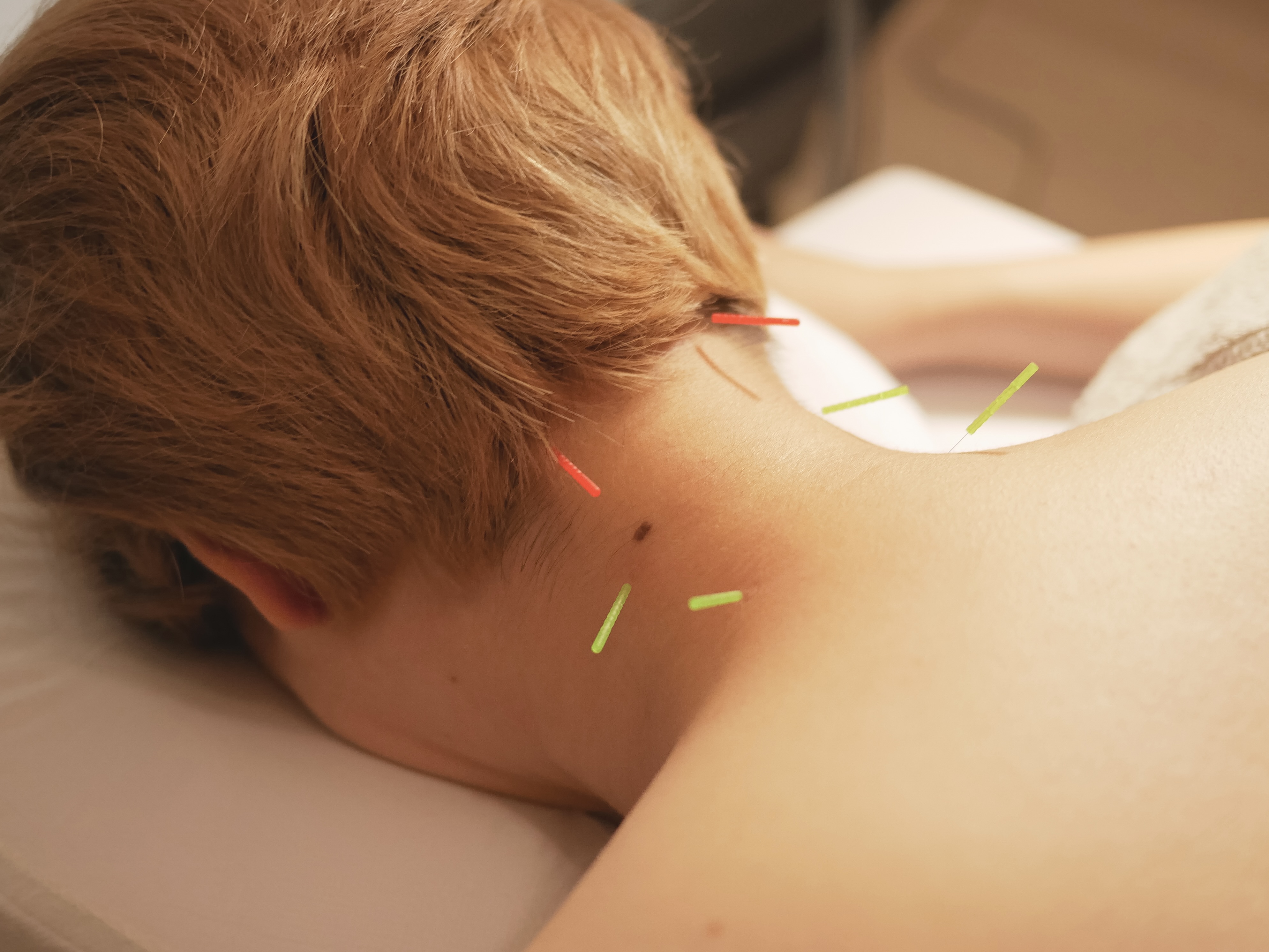 鍼灸マッサージ 眠り猫 集中ケア (15分)のメニュー画像