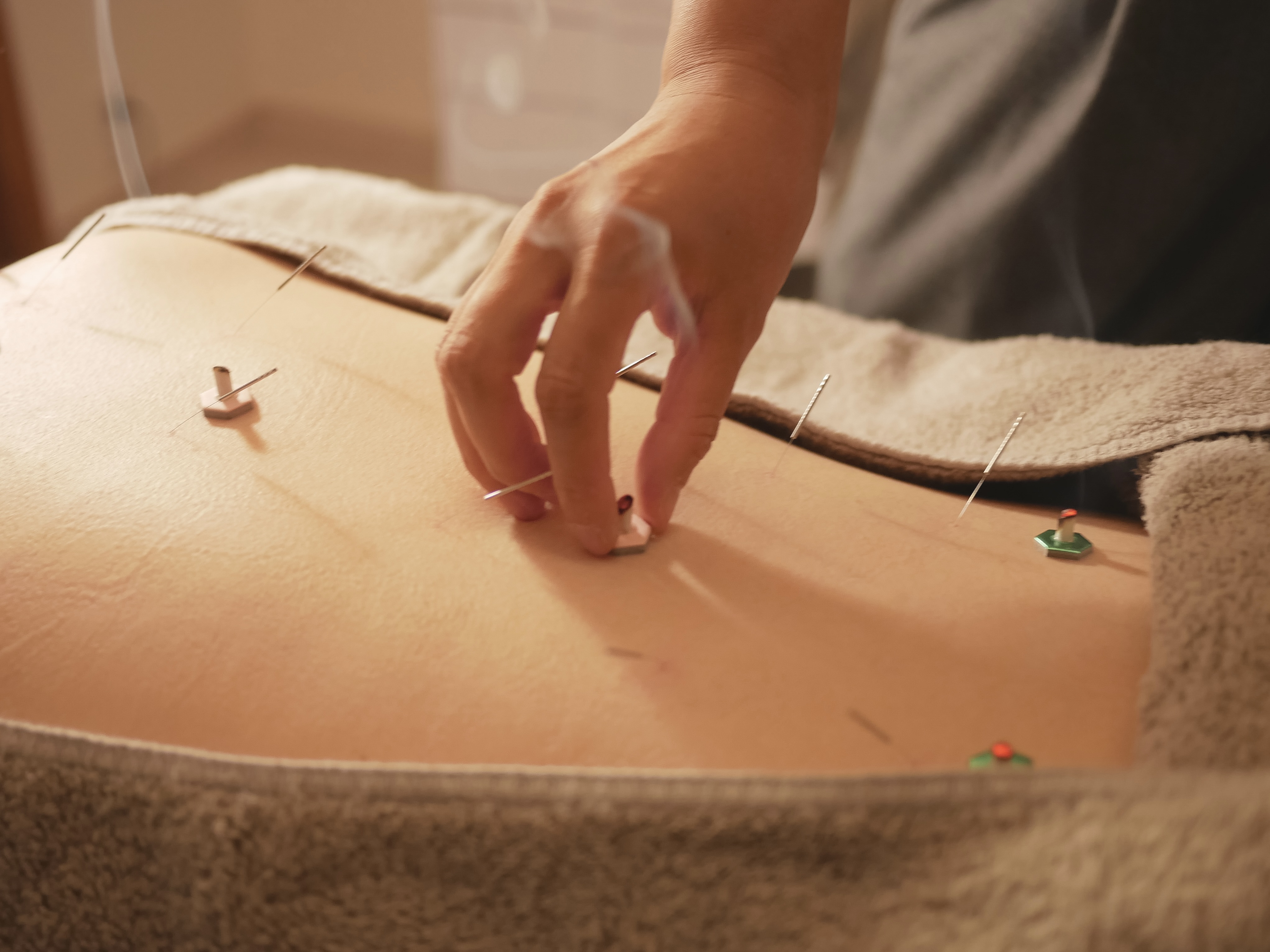 鍼灸マッサージ 眠り猫 集中ケア (30分)のメニュー画像