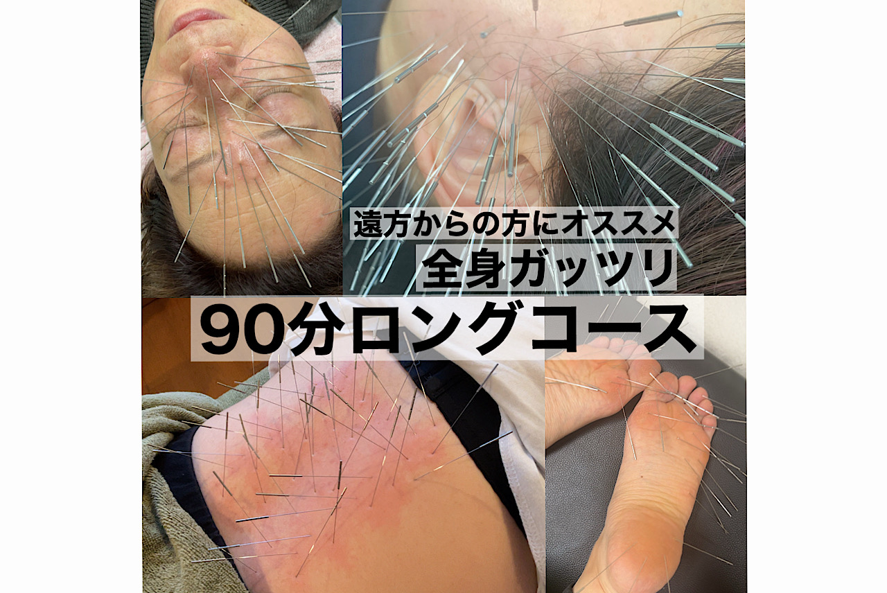 みやけ鍼灸院（ルート治療） ルート治療90分　ロングのメニュー画像
