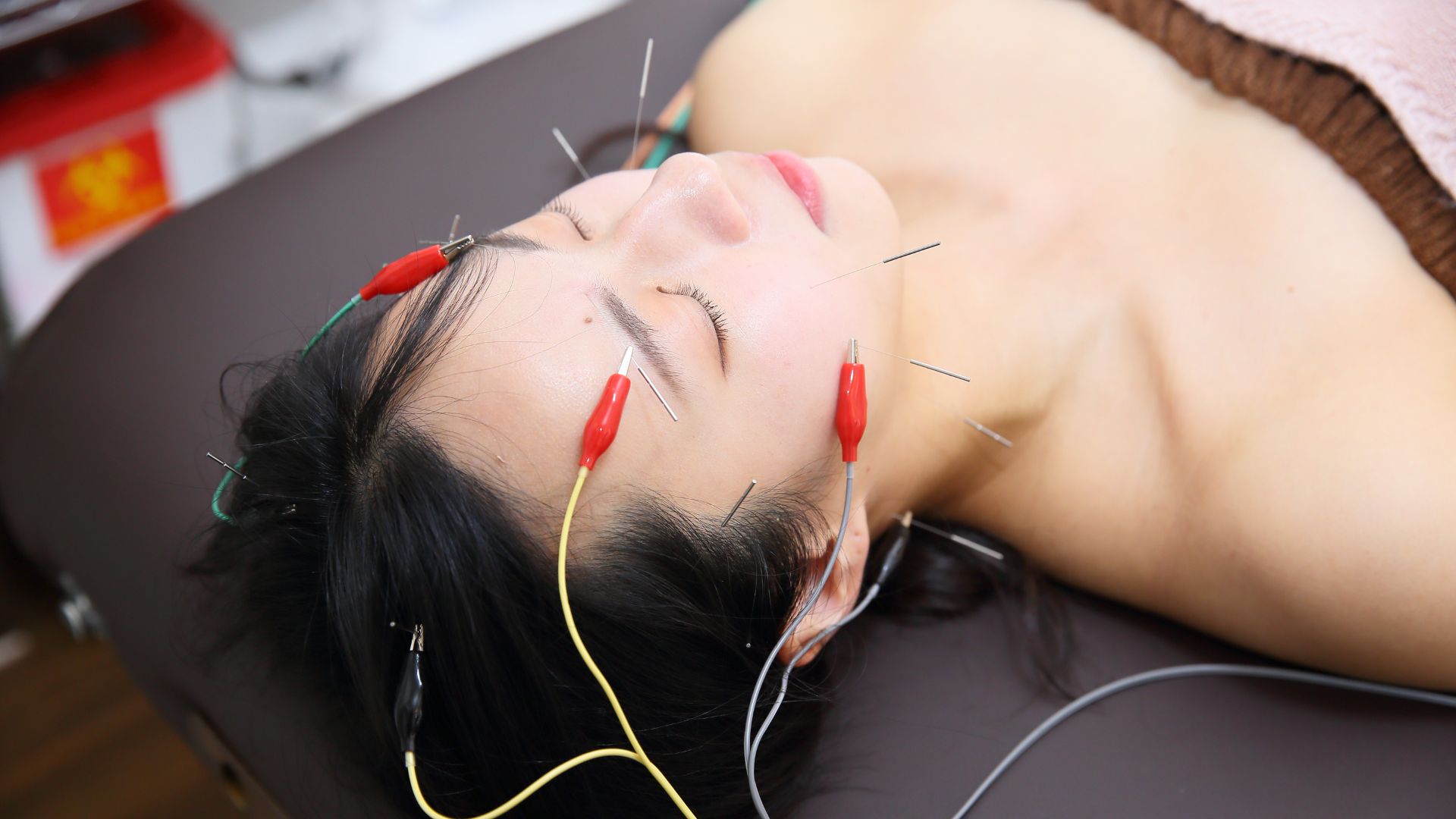 美容鍼サロン ボディコンディション 首肩ケア＋電気を流す美容鍼／セット体験コースのメニュー画像