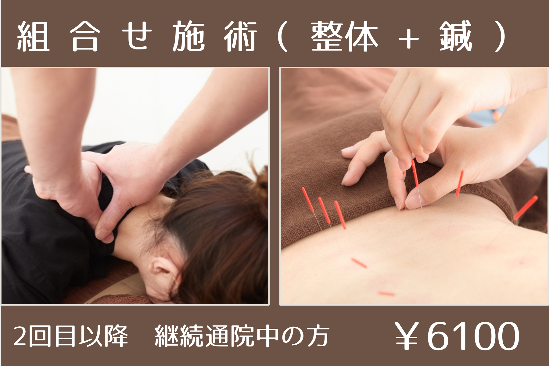 那覇市新都心スマイルなごみ鍼灸整骨院 ［２回目以降］整体 + 鍼灸（根本改善コース) 50分のメニュー画像