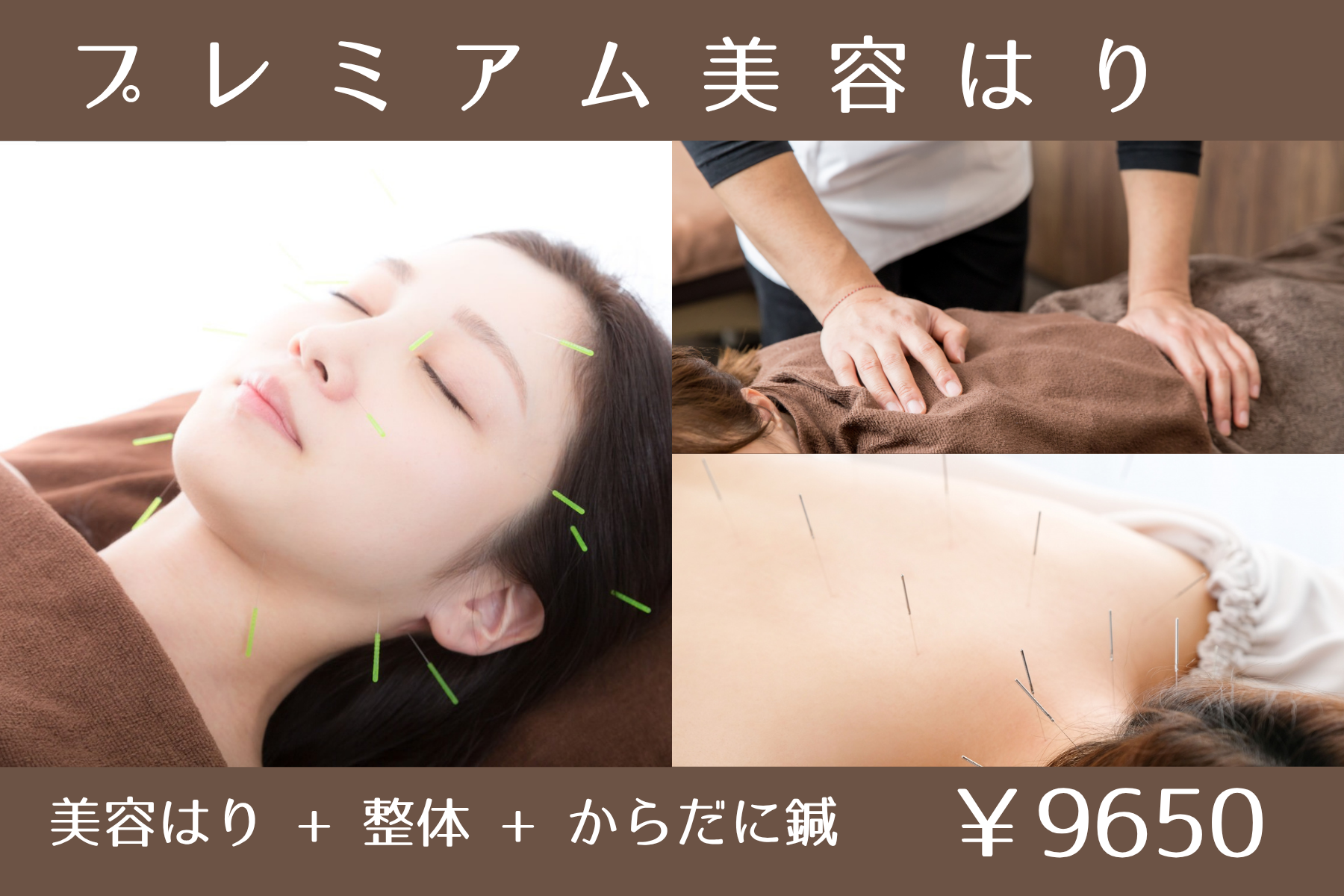 那覇市新都心スマイルなごみ鍼灸整骨院 プレミアム美容はりのメニュー画像