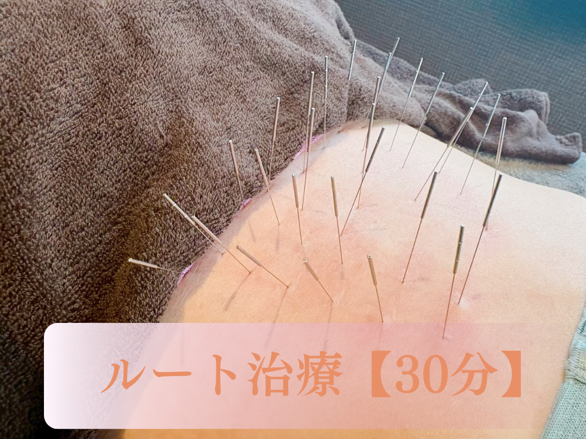 水社-SUI SHA-鍼灸院 　ルート治療 ルート治療【30分】のメニュー画像