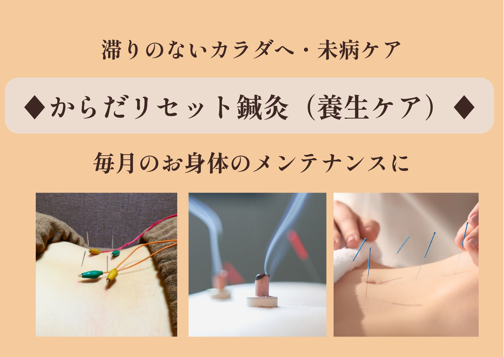 ゆり鍼灸院 からだリセット鍼灸【養生鍼灸】・毎月のメンテナンスにのメニュー画像