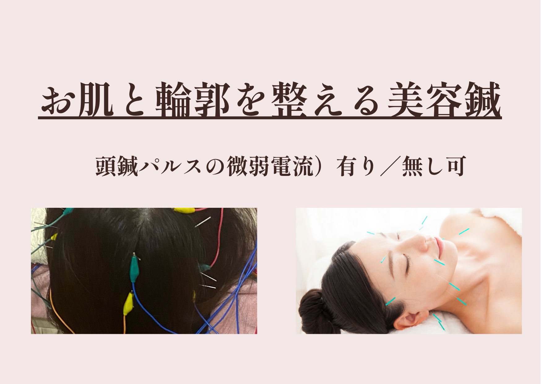 ゆり鍼灸院 お肌と輪郭を整える美容鍼（フェイスラインのもたつき・お肌くすみ）のメニュー画像