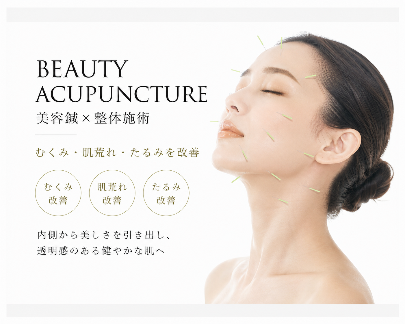 【初回限定】美容鍼＋整体