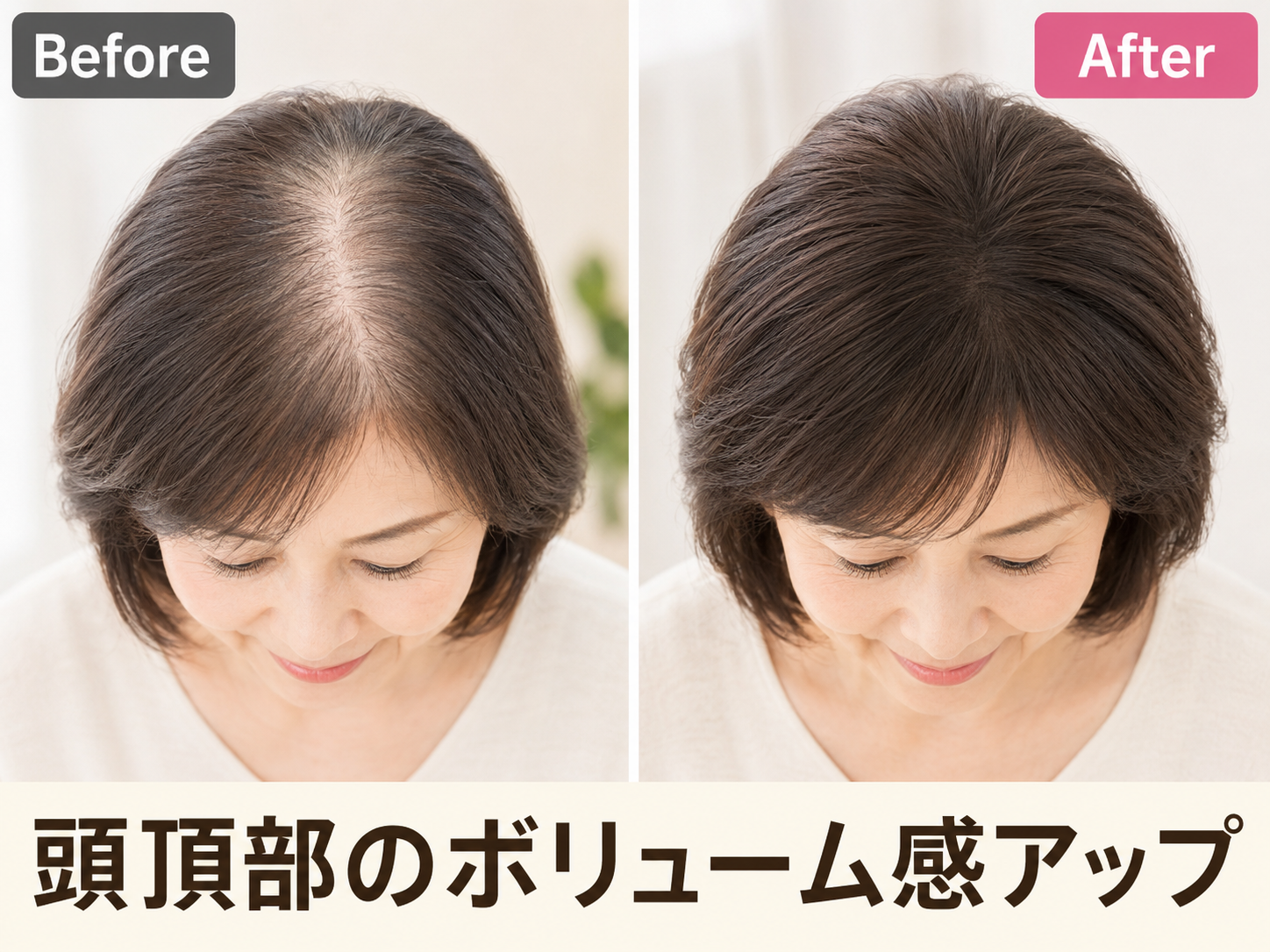 美顔鍼灸整体院凛と慶 【残1名様】抜け毛が減る！太さが変わる！育毛薄毛改善プログラムのメニュー画像