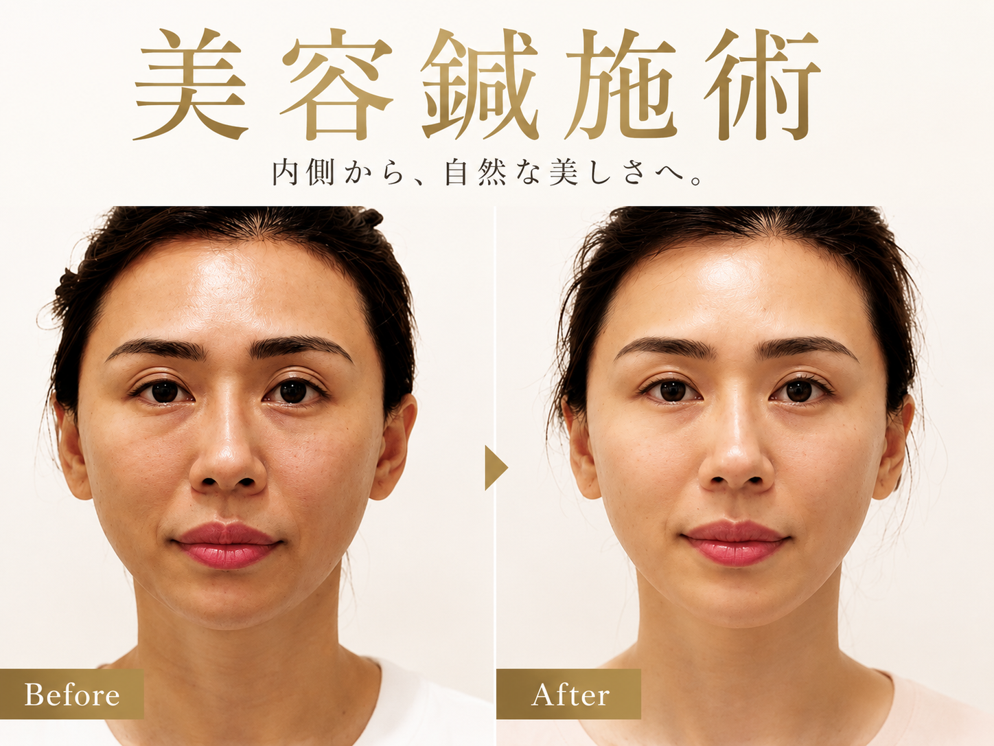 顔の整体・美容鍼灸サロンwill四條畷院 院詳細 | 北河内・東大阪の鍼灸