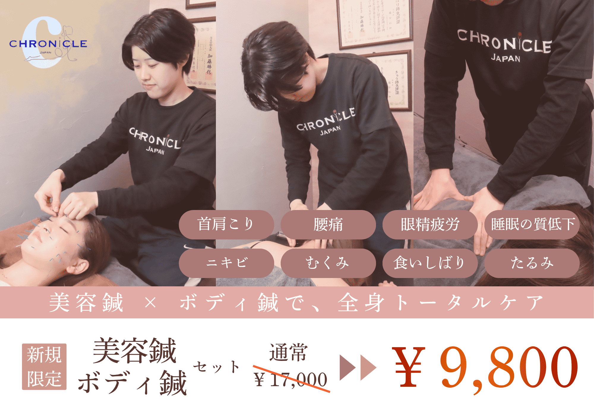 CHRONICLE鍼灸院 《お得なセット♪》全身ボディ鍼灸＋美容鍼灸＋もみほぐし ¥17000→¥9800のメニュー画像