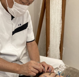 美容鍼灸「青い小鳥」・メディカルエステCRÉAのスタッフ画像-0