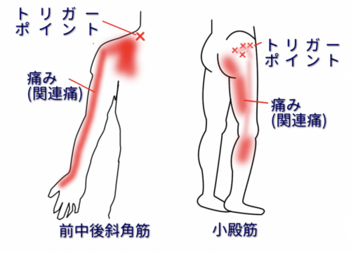 名古屋トリガーポイント治療院 名古屋市東部の鍼灸院