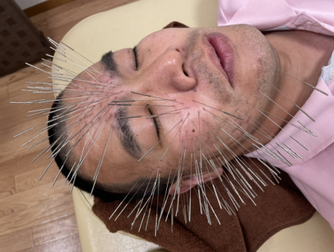 鍼処shirakawa西東京院 吉祥寺 三鷹 武蔵境の鍼灸院