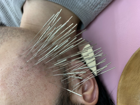 鍼処shirakawa西東京院 吉祥寺 三鷹 武蔵境の鍼灸院