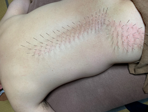 鍼処shirakawa 栃木院 小山 佐野 栃木の鍼灸院