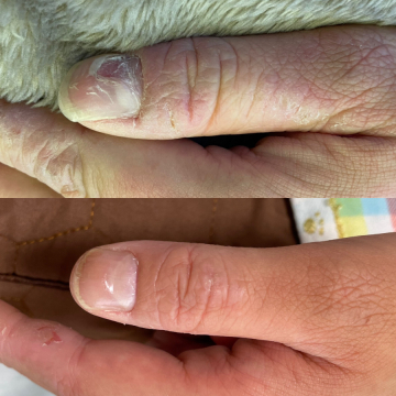 ルート鍼灸治療院ほむら