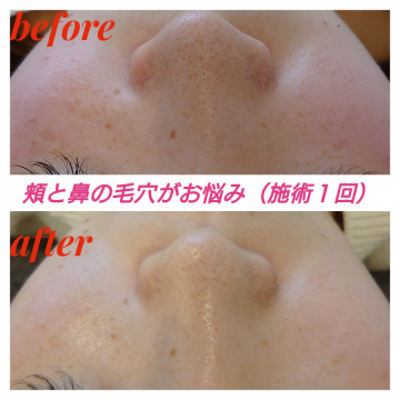 美容鍼コンディショニングサロンjoie ジョア 広島市周辺の鍼灸院