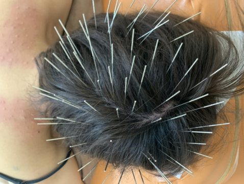 鍼処shirakawa西東京院 吉祥寺 三鷹 武蔵境の鍼灸院