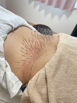 ルート鍼灸治療院ほむら