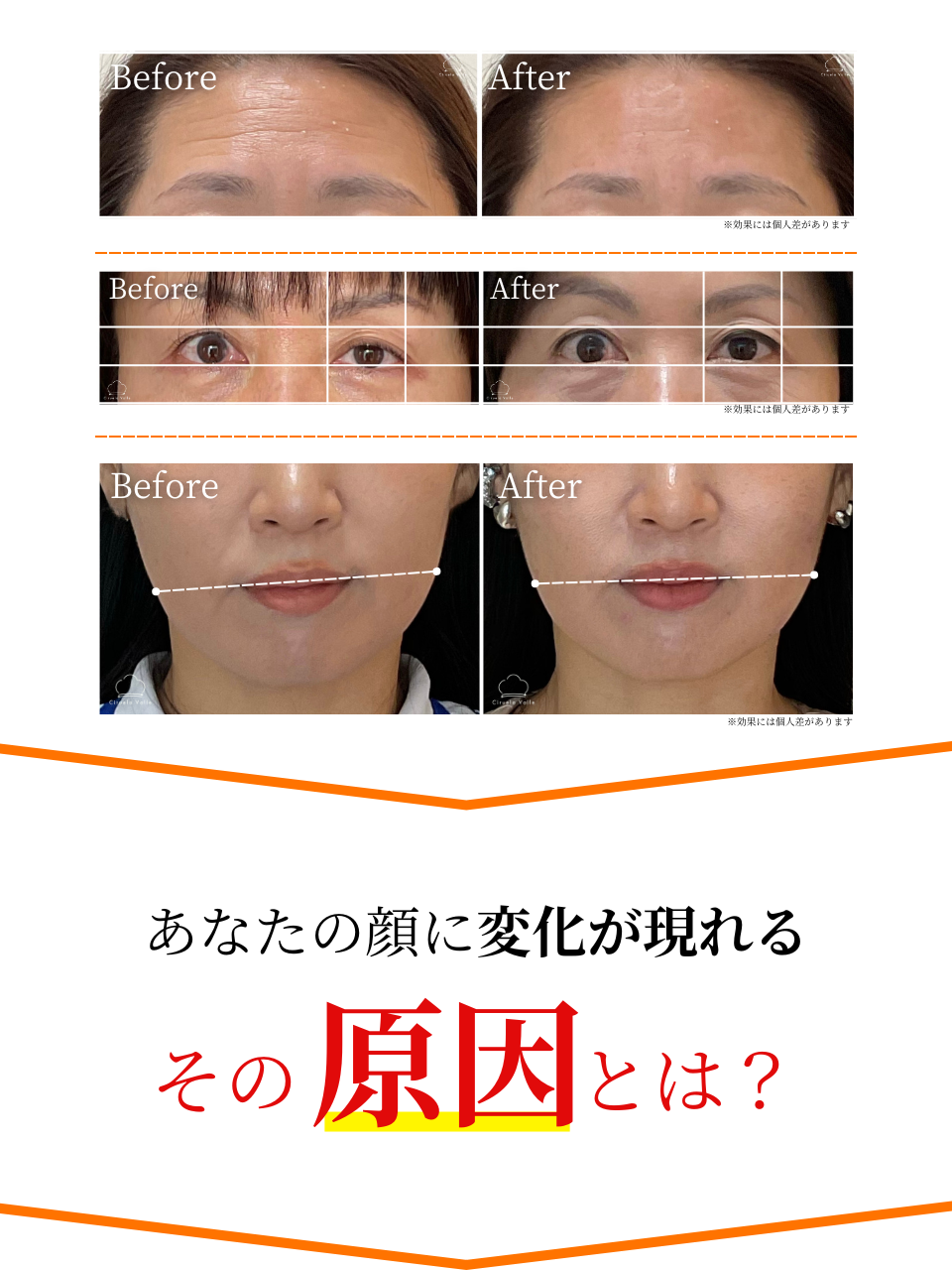 −美容鍼・小顔専門−鍼灸CiruelaValle 院詳細 | 西宮・宝塚・芦屋の